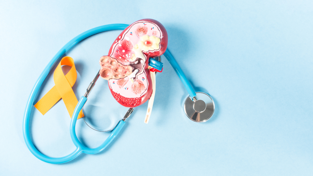 Makanan yang Bisa Memicu dan Mencegah Batu Ginjal