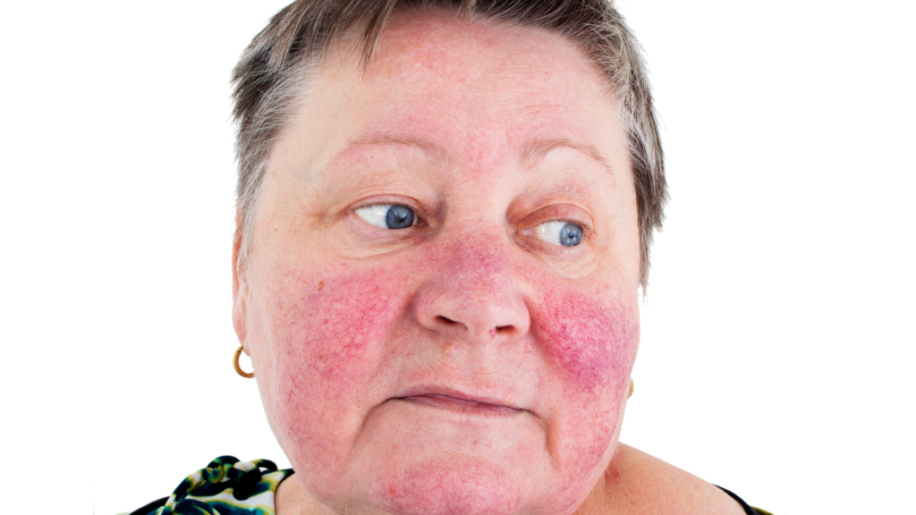 Masalah Kulit yang Sering Ditangani Dokter Spesialis dan Cara Pencegahannya