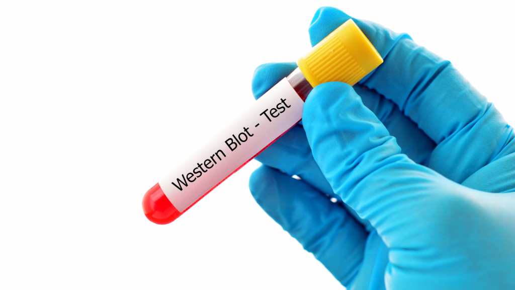 Panduan Lengkap Western Blot Analyzer: Cara Kerja dan Manfaatnya