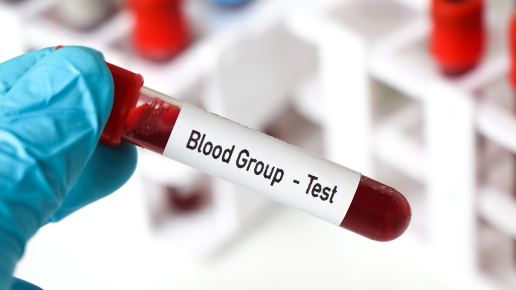 Blood Culture System: Keunggulan, Tantangan, dan Inovasi Terbaru