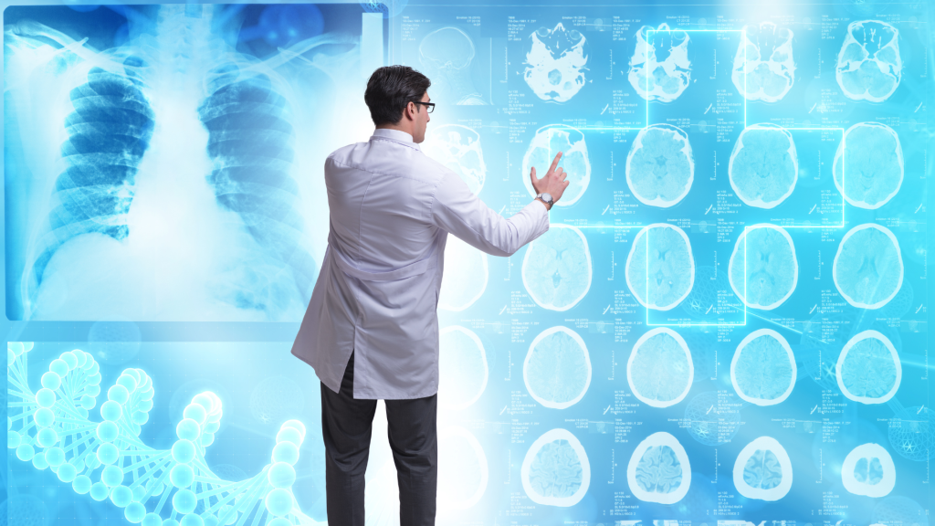 Kecanggihan Teknologi dalam Neuroradiologi untuk Diagnosis Lebih Akurat