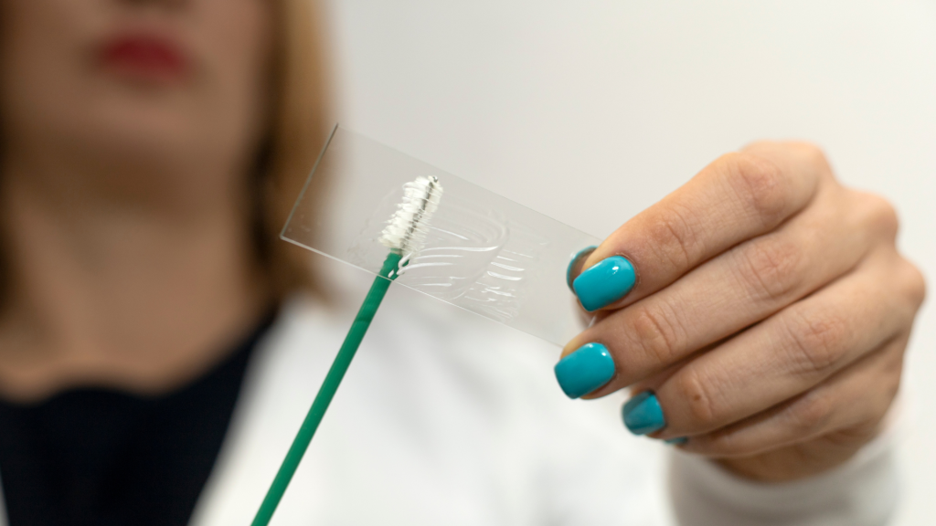 Pemeriksaan Sitologi: Deteksi Dini Kanker dari Sampel Sel