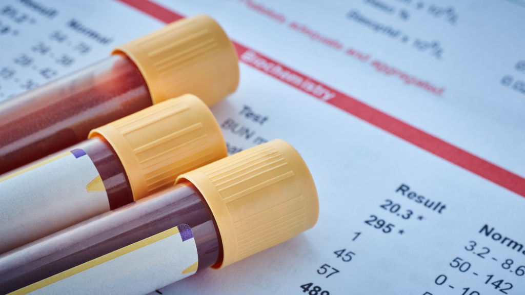 Golongan Darah dan Nutrisi: Apakah Diet Berdasarkan Golongan Darah Efektif?