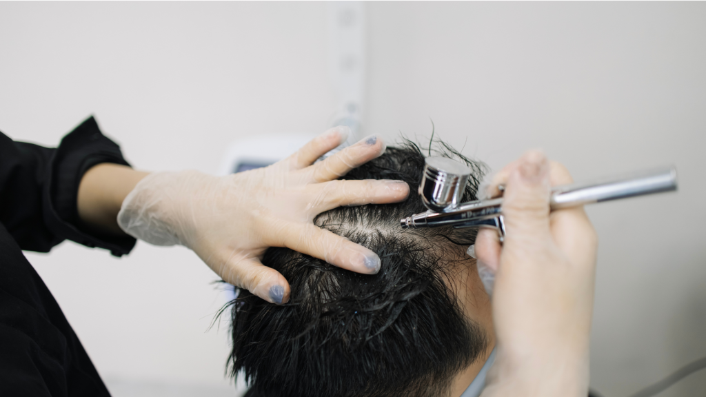 Cara Merawat Kulit Kepala agar Terhindar dari Ketombe