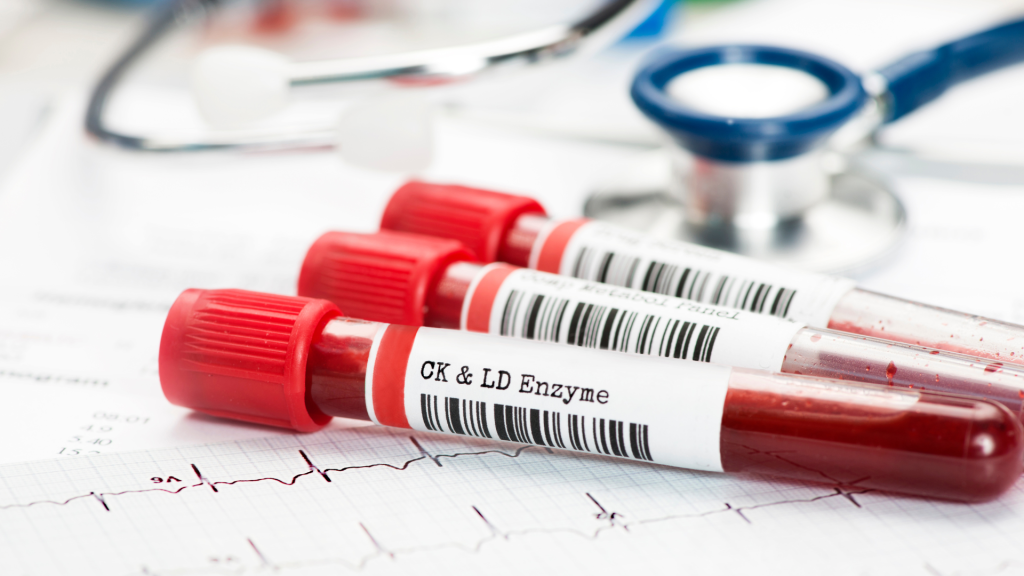 Pemeriksaan Darah Rutin: Kenali Kesehatan Organ Dalam Tanpa Gejala