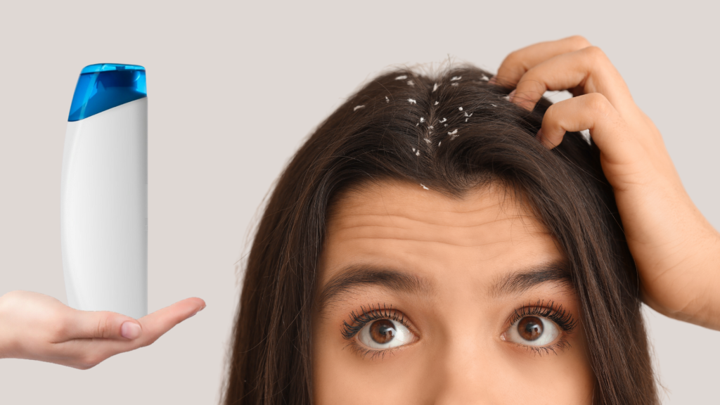 Shampo Anti-Ketombe: Bagaimana Memilih yang Sesuai Jenis Kulit Kepala