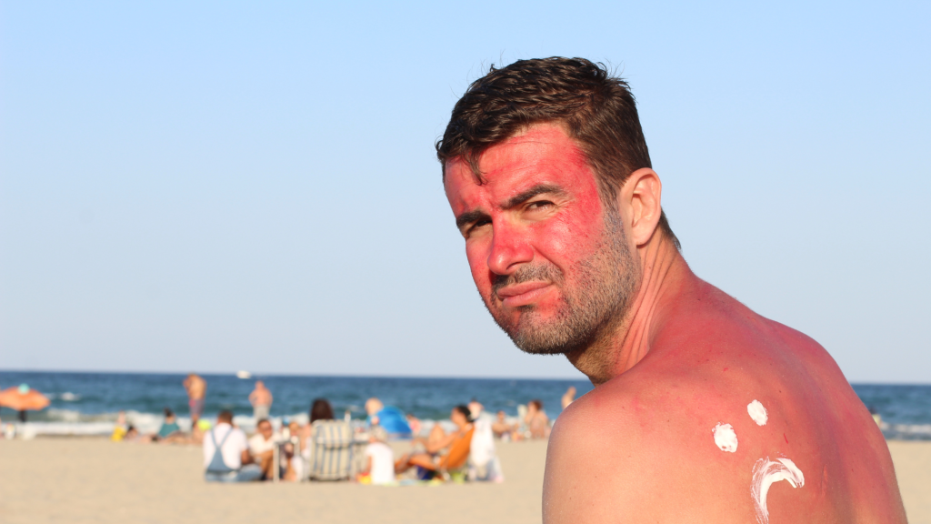 Paparan Sinar Matahari Tanpa Perlindungan: Pemicu Keriput Sejak Dini