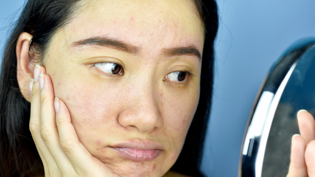 Jarang Minum Air Putih? Waspadai Kulit Kusam dan Garis Halus Lebih Cepat