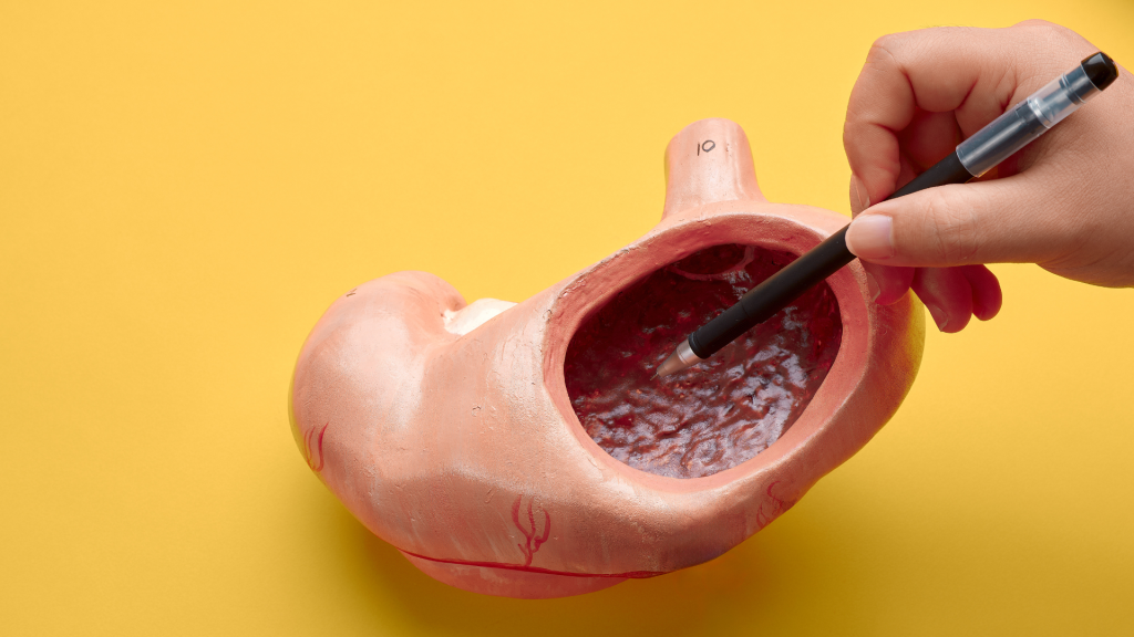 Penyakit Liver Kronis: Silent Killer yang Sering Terdiagnosis Terlambat