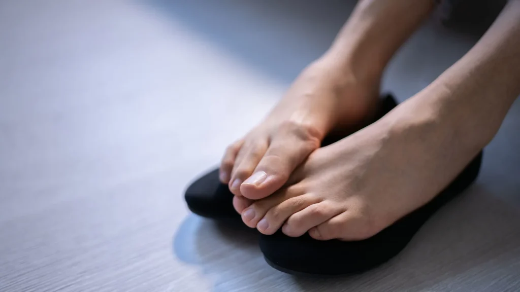 Apakah Keringat Berlebih di Kaki Selalu Menyebabkan Bau?