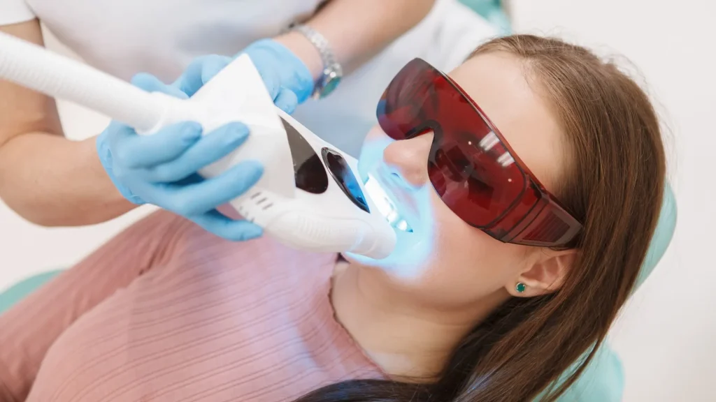 Gigi Sensitif karena Pemutihan Gigi: Risiko dan Pencegahan