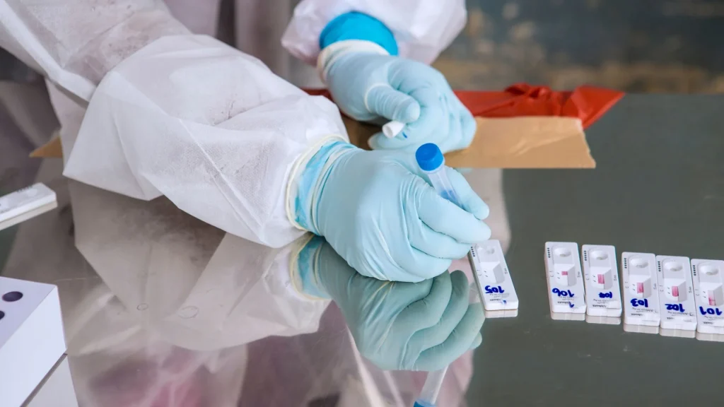 Tes G6PD adalah pemeriksaan darah yang digunakan untuk mengukur kadar enzim Glucose-6-Phosphate Dehydrogenase dalam tubuh.