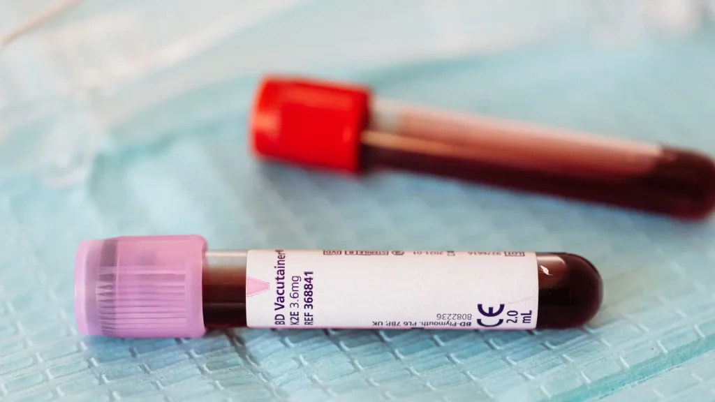 Sepsis merupakan reaksi ekstrem tubuh terhadap infeksi yang dapat mengancam jiwa.