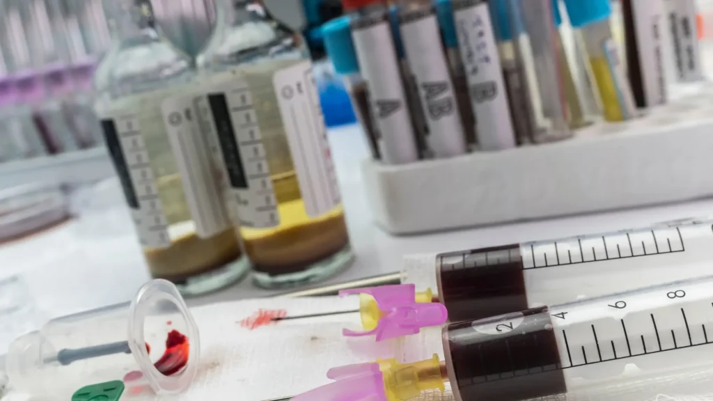 Blood culture atau kultur darah merupakan alat diagnostik utama untuk mendeteksi infeksi dalam aliran darah, termasuk sepsis.