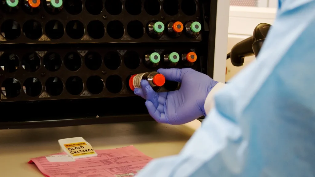 Blood culture atau kultur darah adalah pemeriksaan penting untuk mendeteksi infeksi dalam aliran darah, terutama sepsis.