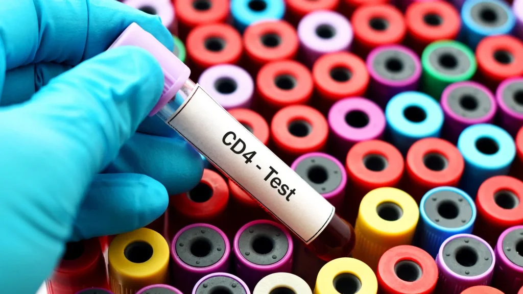 CD4 Counter adalah alat diagnostik yang digunakan untuk menghitung jumlah sel CD4 dalam darah.