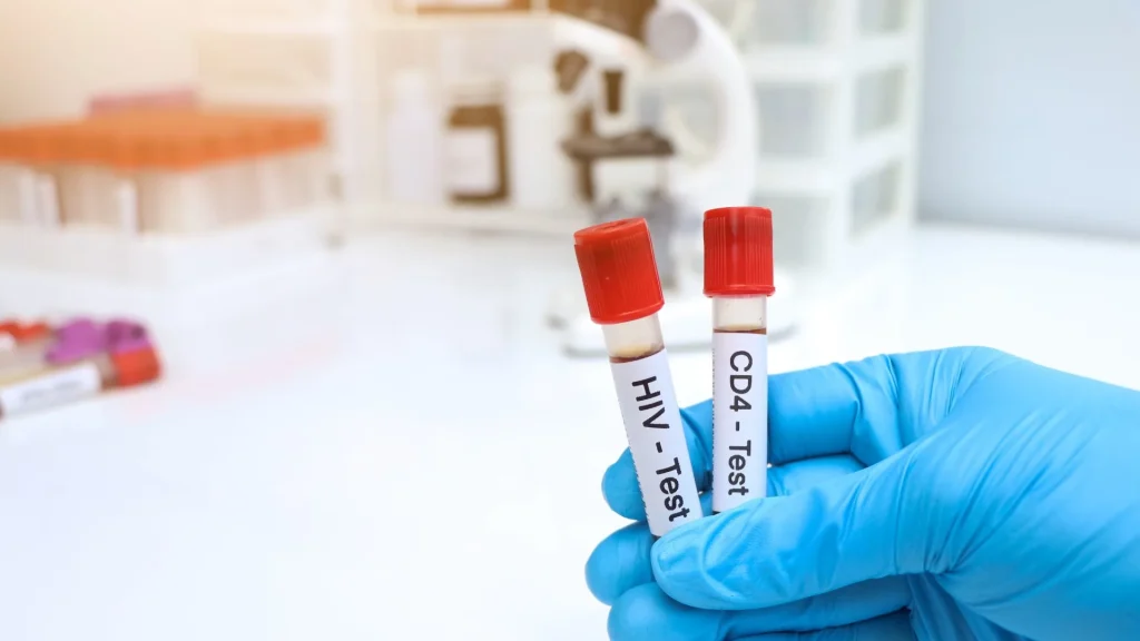 Infeksi HIV menyerang sistem imun dengan menargetkan sel CD4, sejenis sel T-helper yang krusial dalam pertahanan tubuh terhadap infeksi.