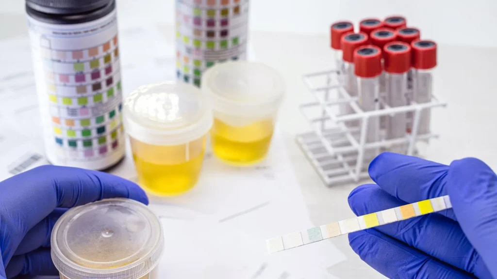 CD4 Counter adalah alat laboratorium yang digunakan untuk menghitung jumlah sel CD4 dalam darah.