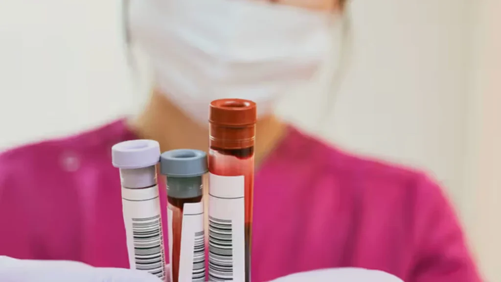 Sel CD4 adalah komponen kunci dari sistem kekebalan tubuh.