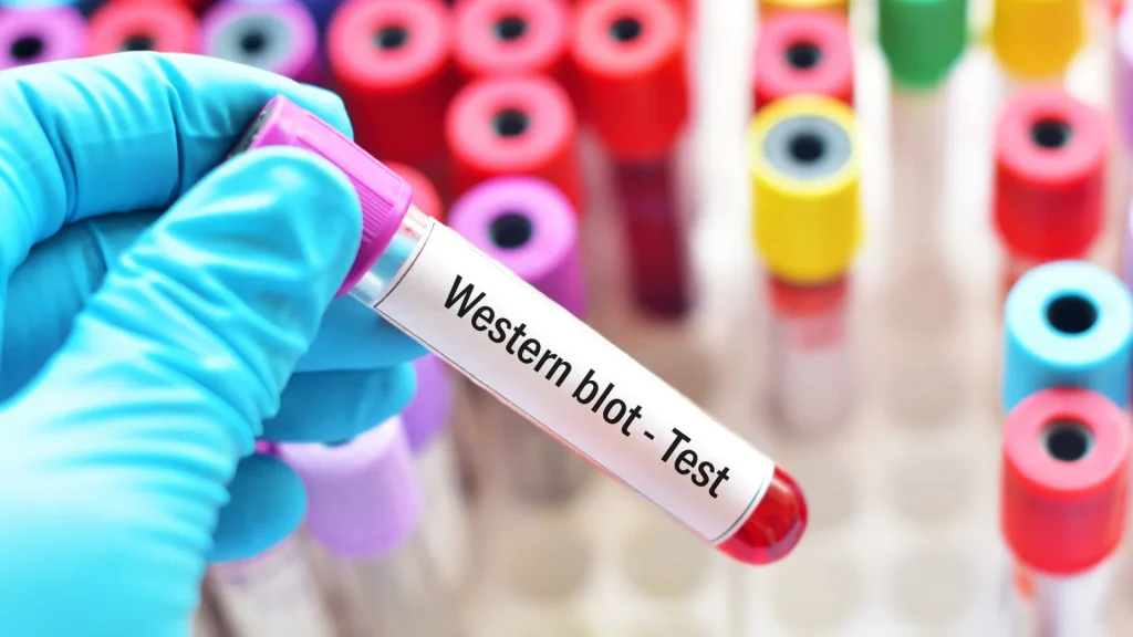 Western Blot dan ELISA adalah dua teknik penting dalam bidang diagnostik dan penelitian biomedis.