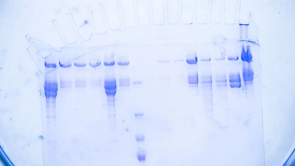 Teknologi Western Blot telah mengalami transformasi signifikan dari sistem manual yang memakan waktu menjadi sistem modern yang lebih efisien dan akurat.