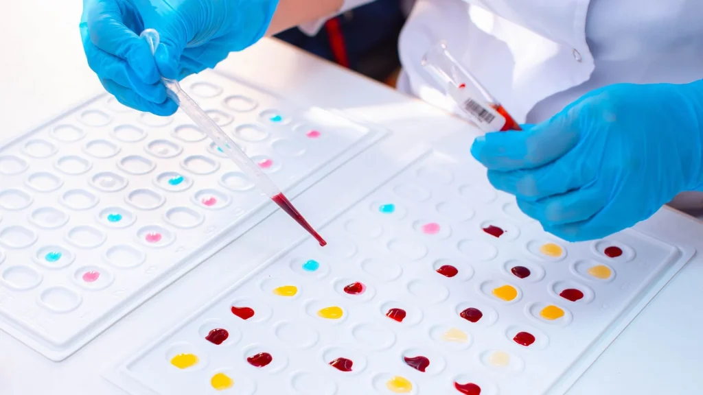 Blood typing kit adalah alat yang digunakan untuk menentukan golongan darah seseorang secara cepat dan akurat.