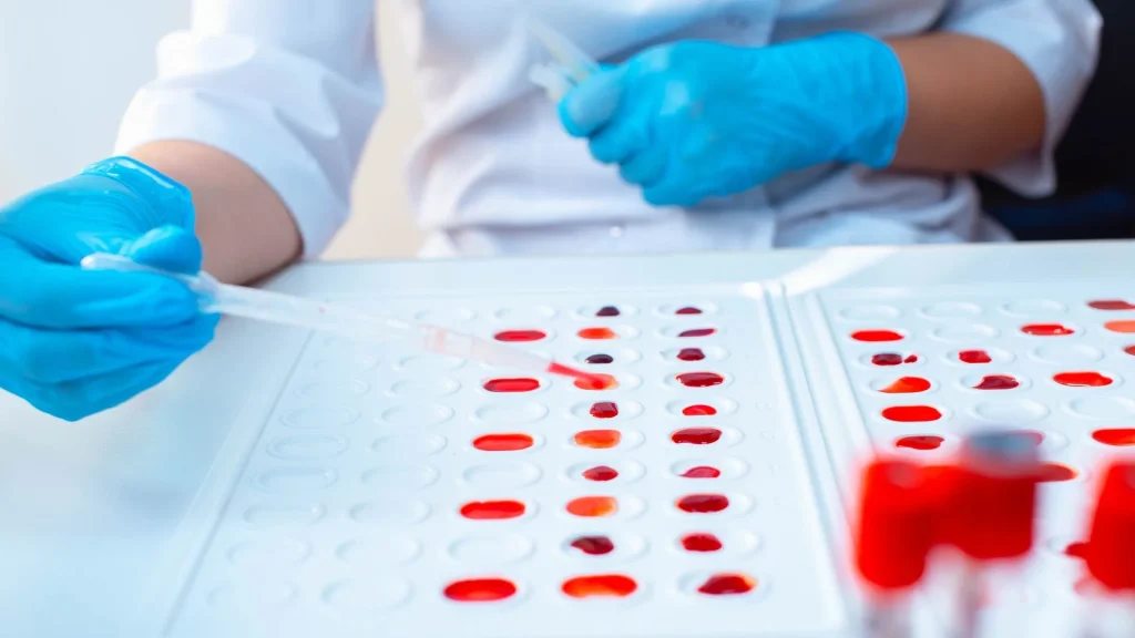 Blood typing kit bekerja berdasarkan reaksi antigen dan antibodi yang terdapat pada permukaan sel darah merah.