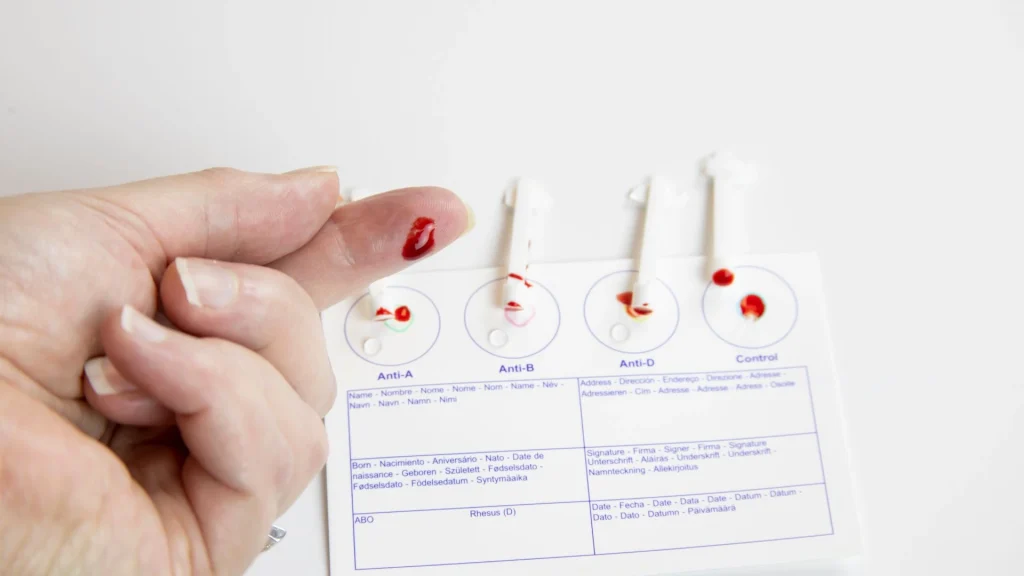 Blood typing kit merupakan alat diagnostik cepat yang mampu menentukan golongan darah seseorang secara praktis dan efisien.