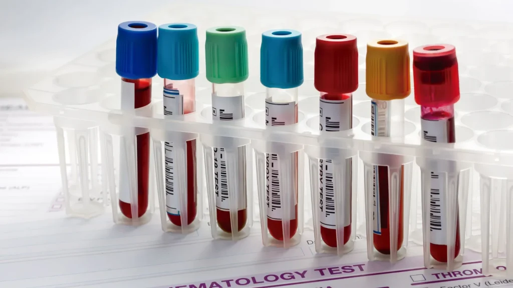 Hematology reagent adalah bahan kimia yang digunakan dalam alat hematologi otomatis untuk membantu analisis darah lengkap atau Complete Blood Count (CBC).