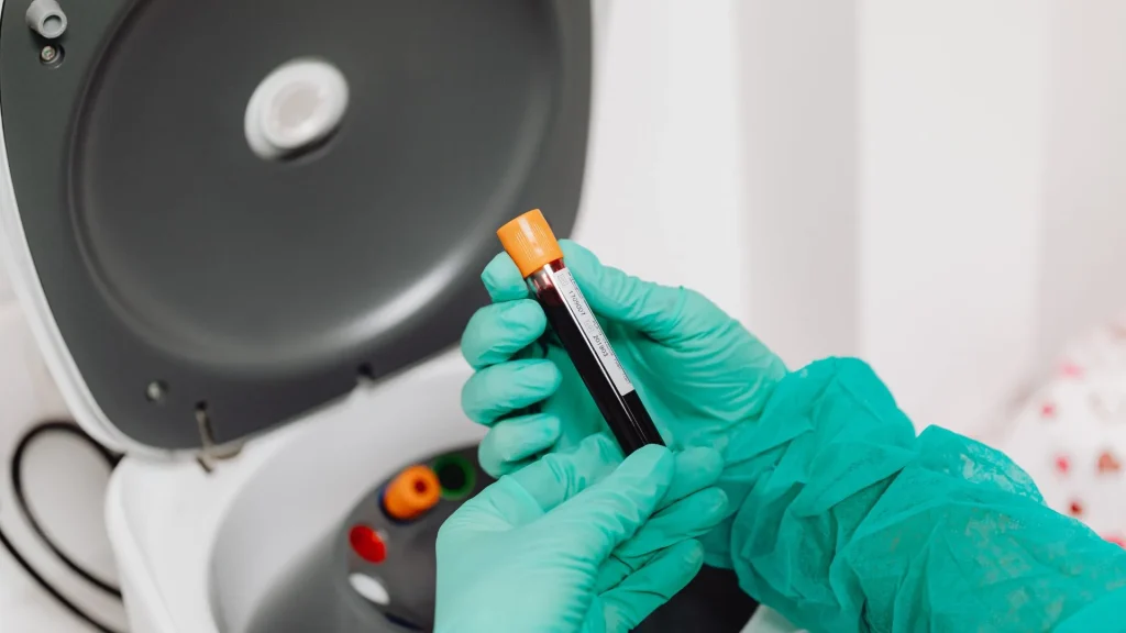 Dalam dunia laboratorium klinik, hematology reagent berperan penting dalam mendeteksi dan mengukur komponen darah seperti sel darah merah, sel darah putih, dan trombosit.