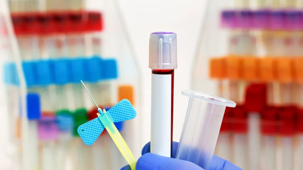 Venipuncture set merupakan salah satu alat penting dalam dunia laboratorium klinik maupun rumah sakit.