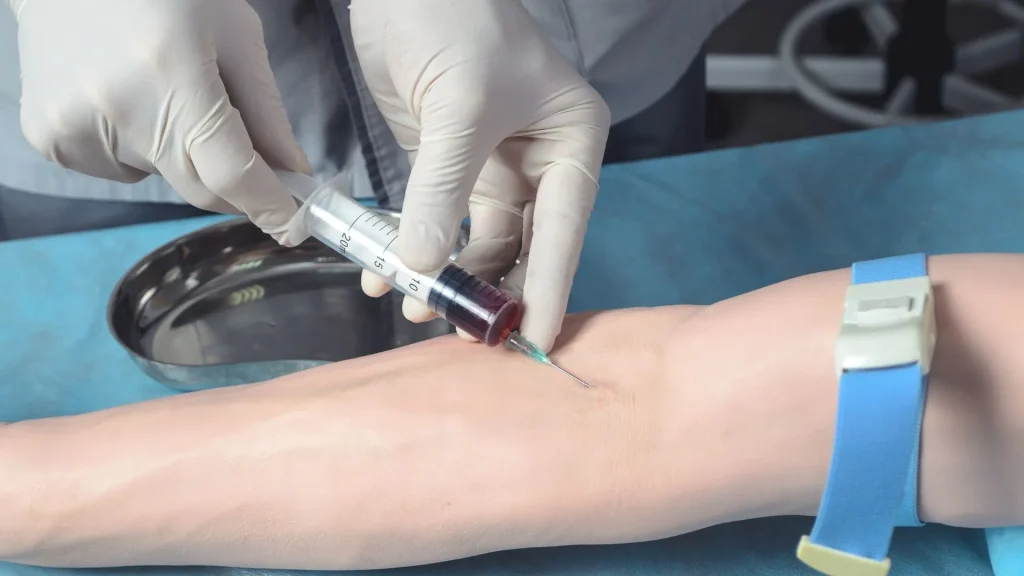 Venipuncture set merupakan alat penting dalam prosedur pengambilan darah vena untuk keperluan diagnostik laboratorium.