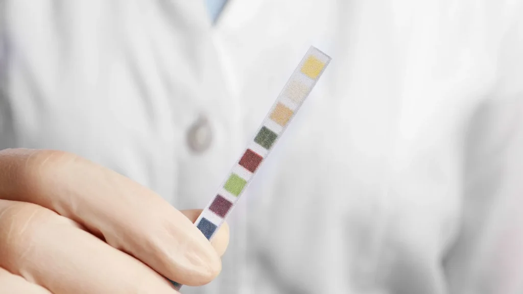 Ketone Test Strip adalah alat diagnostik berbentuk strip kecil yang digunakan untuk mendeteksi keberadaan keton dalam urin.