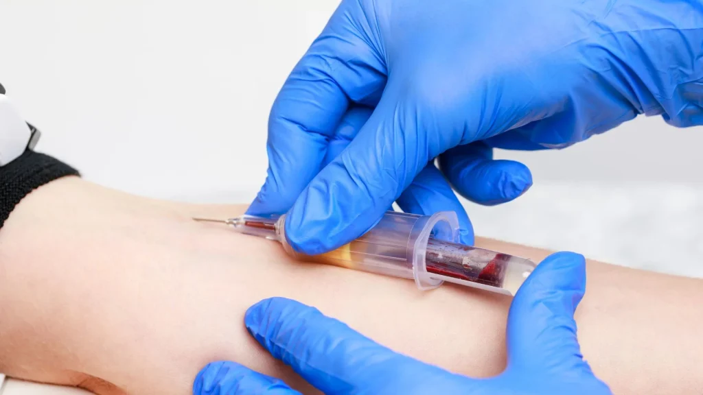 Venipuncture set sekali pakai adalah alat medis steril yang digunakan untuk pengambilan darah melalui pembuluh vena dan langsung dibuang setelah satu kali pemakaian.