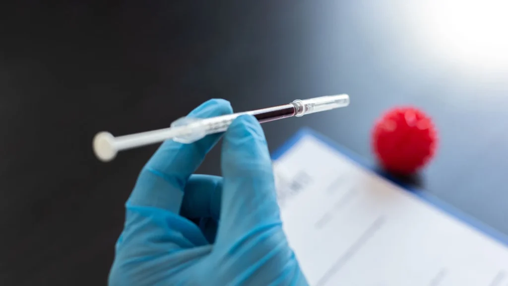 Arterial Blood Gas (ABG) adalah pemeriksaan penting untuk menilai status pernapasan dan metabolisme pasien.