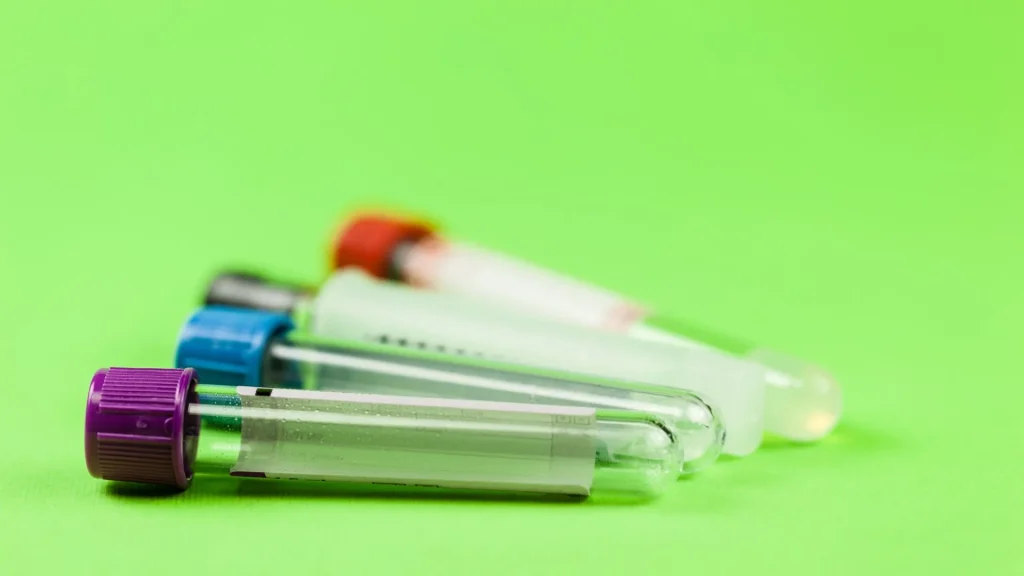 Dalam pemeriksaan laboratorium, kualitas sampel sangat menentukan akurasi hasil.