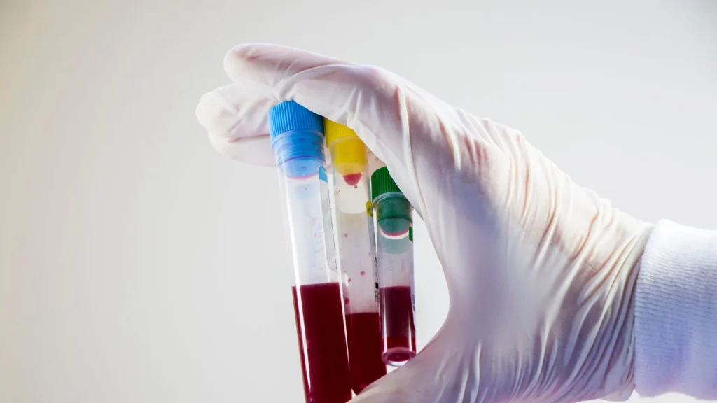 Dalam pemeriksaan laboratorium, keakuratan dan kecepatan sangat krusial.