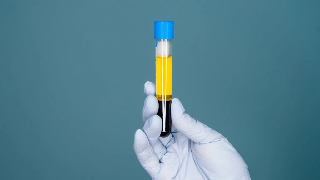 Dalam dunia diagnostik medis, plasma darah memegang peranan penting karena mengandung berbagai biomolekul yang digunakan untuk menilai kondisi kesehatan pasien.