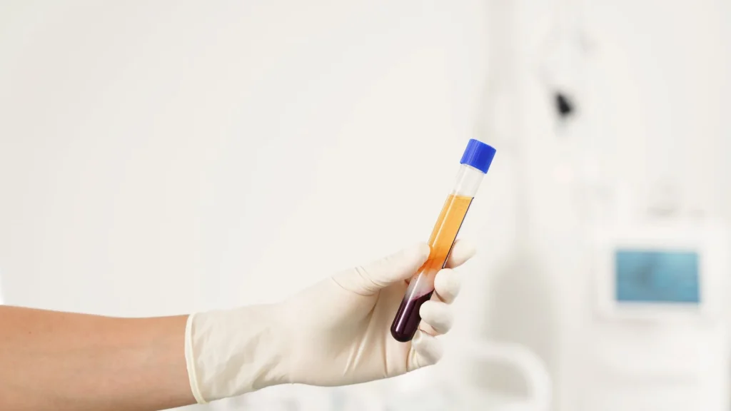 Dalam dunia laboratorium klinis, Plasma Separator Tube (PST) menjadi alat penting untuk memisahkan plasma dari darah secara cepat dan efisien.