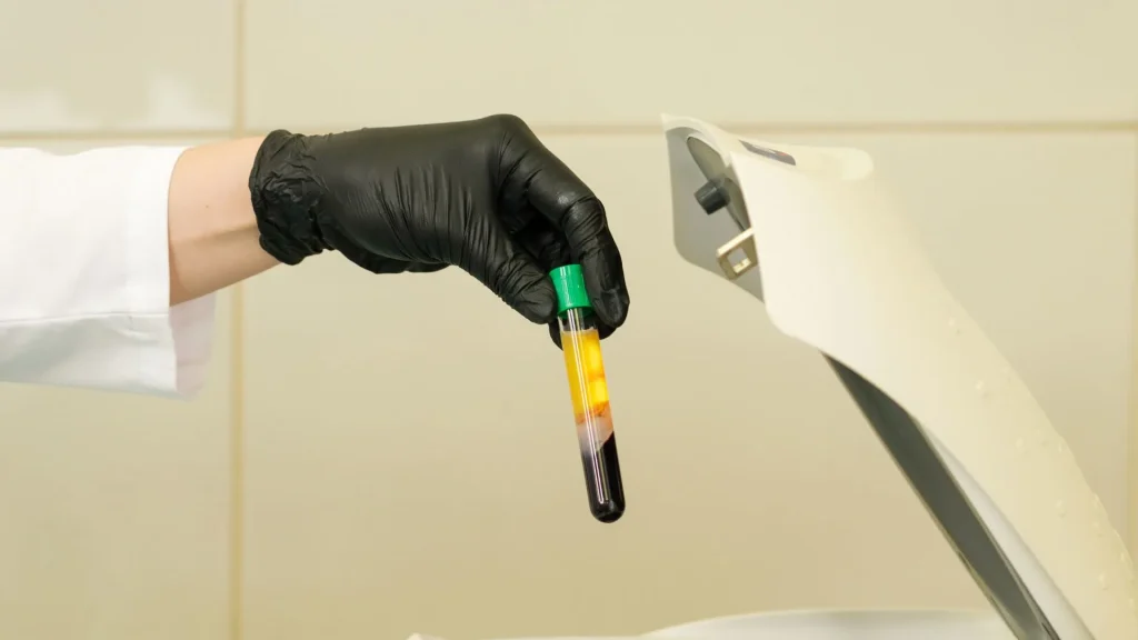 Plasma Separator Tube (PST) adalah alat vital dalam dunia laboratorium yang digunakan untuk memperoleh plasma dari darah utuh.