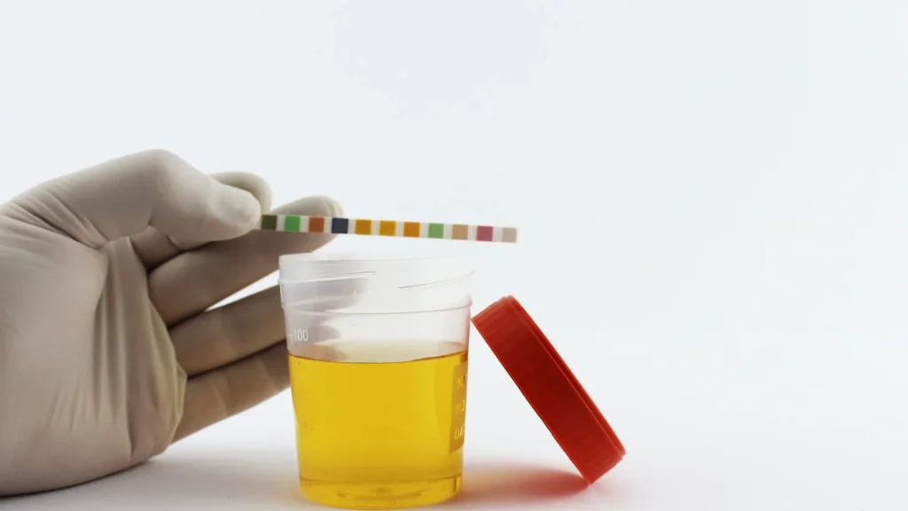 Ketoasidosis diabetik (DKA) adalah kondisi medis serius yang terjadi ketika tubuh memproduksi keton dalam jumlah sangat tinggi akibat kekurangan insulin.