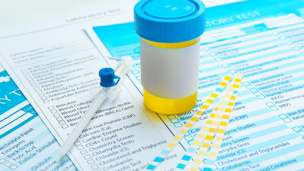 Ketone test strip adalah alat pemantau sederhana namun efektif untuk mengetahui kadar keton dalam tubuh melalui urin.