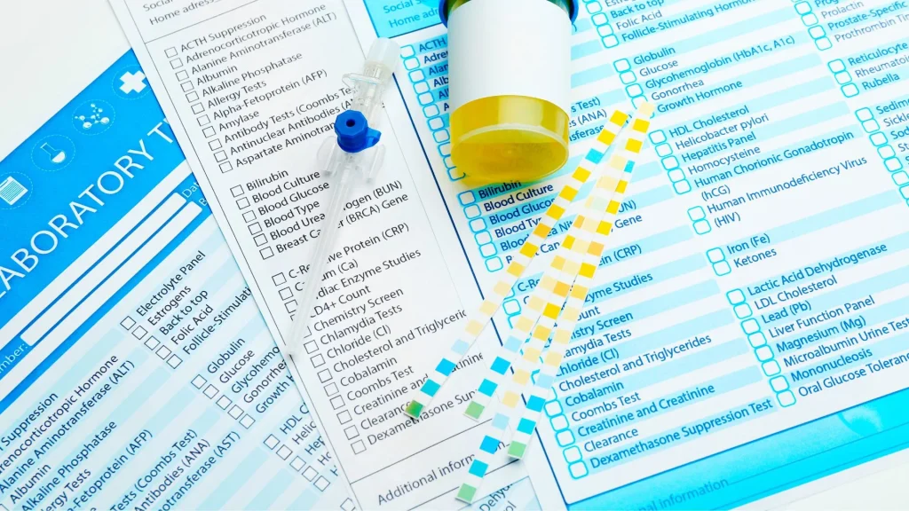 Ketone test strip adalah alat sederhana yang digunakan untuk mendeteksi kadar keton dalam urin.