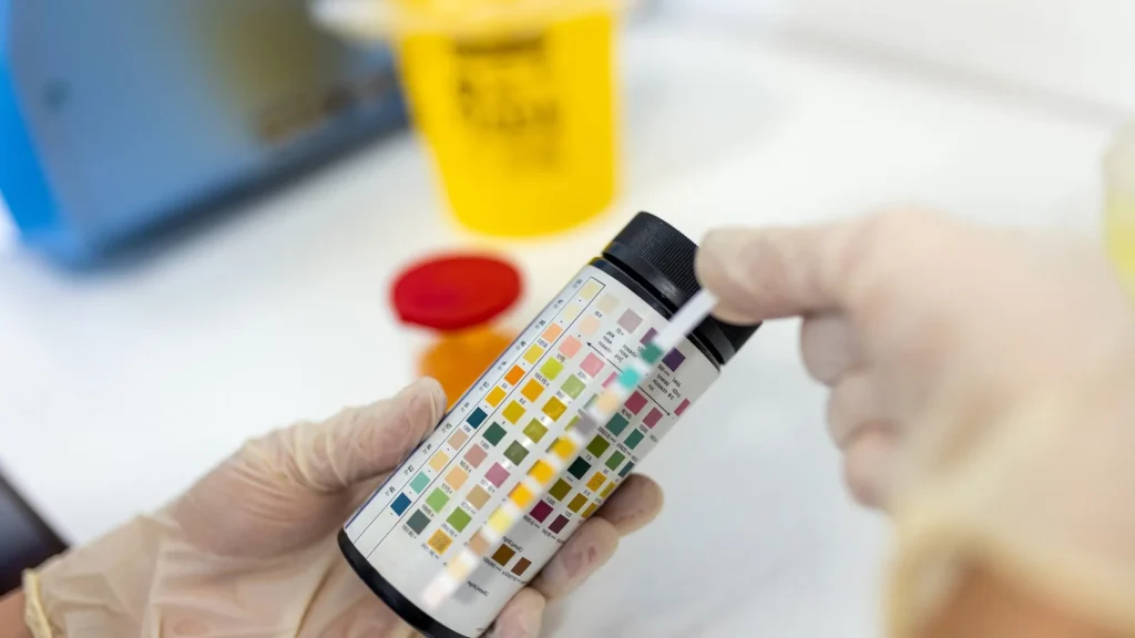 Ketone test strip semakin populer di kalangan pelaku diet ketogenik dan penderita diabetes.