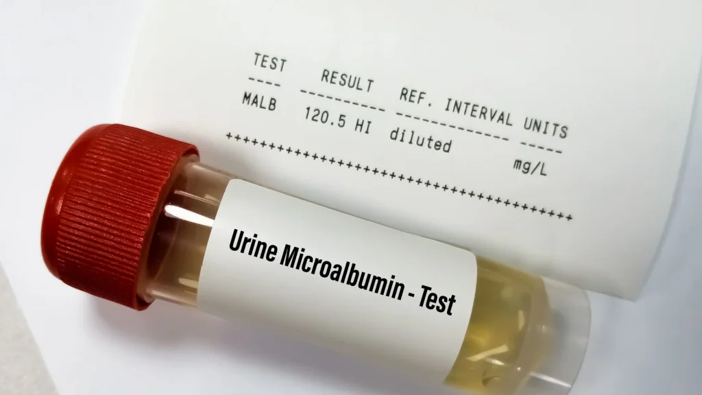 Microalbumin test kit adalah alat uji sederhana yang dirancang untuk mendeteksi adanya albumin dalam urin dalam jumlah kecil.