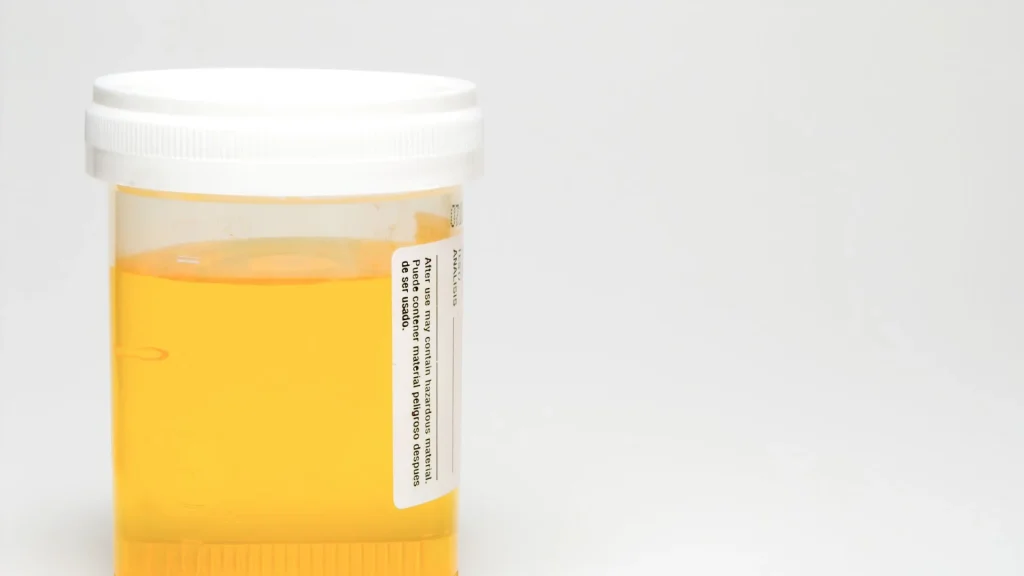 Banyak orang mengira microalbumin test kit dan tes urin biasa sama saja karena keduanya menggunakan sampel urin.