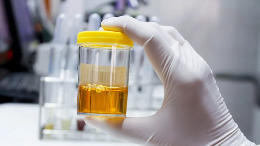 Gangguan ginjal stadium awal sering kali tidak menimbulkan gejala yang jelas.