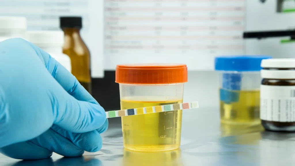 Microalbuminuria adalah kondisi ketika protein albumin ditemukan dalam urin dalam jumlah kecil.