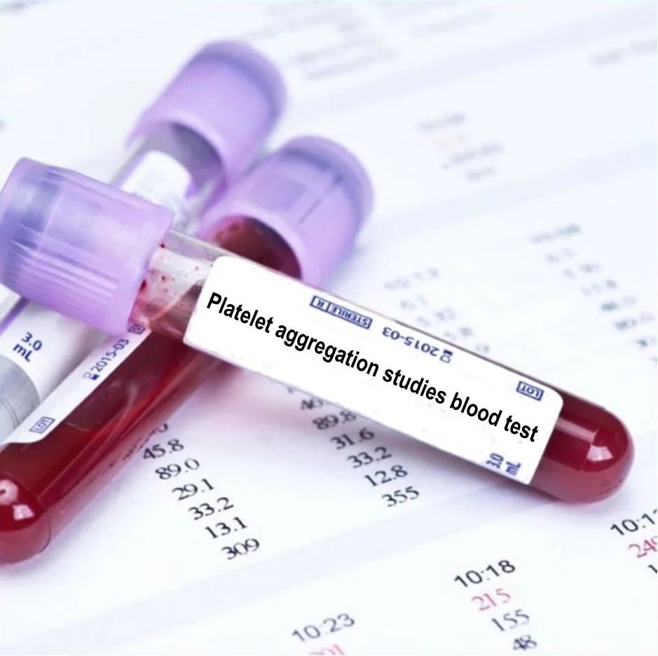 Mengenal Platelet Aggregometer: Alat Uji Fungsi Trombosit