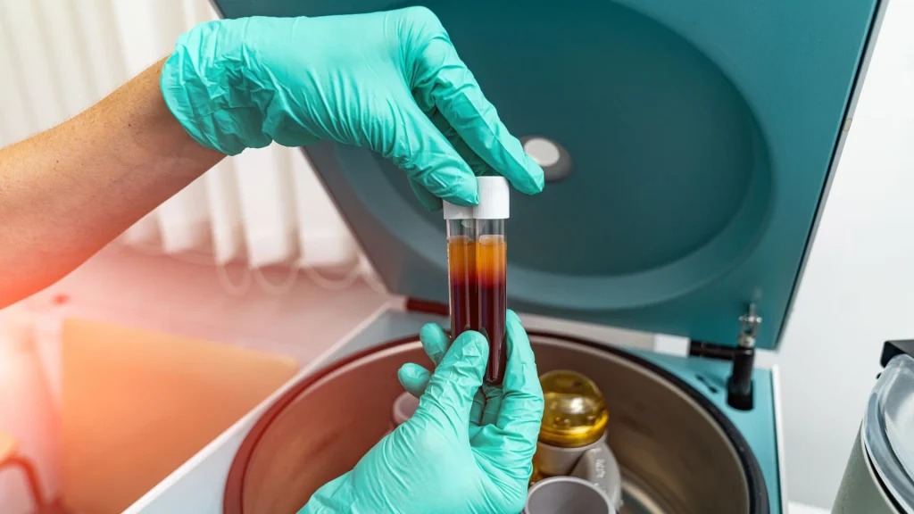 Trombosit adalah komponen penting dalam darah yang berperan dalam proses hemostasis, yaitu mekanisme alami tubuh untuk menghentikan perdarahan.